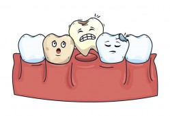 （牙齿松动的治疗办法）牙齿松动还能固定<strong>吗</strong>?牙齿松动如何治疗呢?