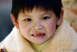 （小孩要换<strong>多</strong>少颗牙）孩子换牙换得好不好，父母有不可推卸的责任!不要留下遗憾!