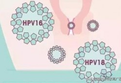 (hpv是什么病)HPV是什么病?哪些亚<strong>型</strong>需要重视?