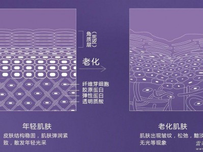 （艾莉薇玻尿酸属于什么档次）玻尿酸为什么这么受欢迎?进口玻尿酸的价格有多贵?