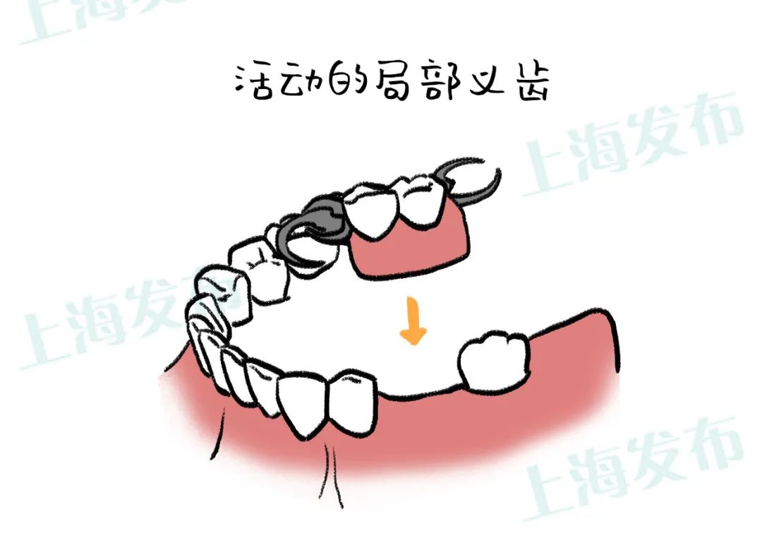 （一颗牙有几根神经）【医聊】怎么结束牙疼?被伤害的牙神经有话说  第12张