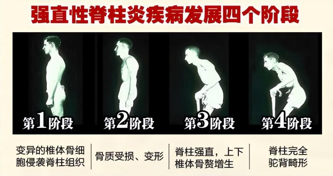 (李宇春身价多少亿)38岁的李宇春患病，为什么身价上亿也治不好?网友:不死的癌症  第5张