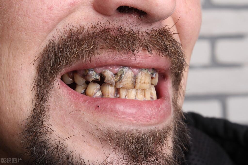 （人有几颗牙齿是正常的）寿命长短和牙齿有关?60岁的人，牙齿剩多少颗正常?医生说出真相  第4张