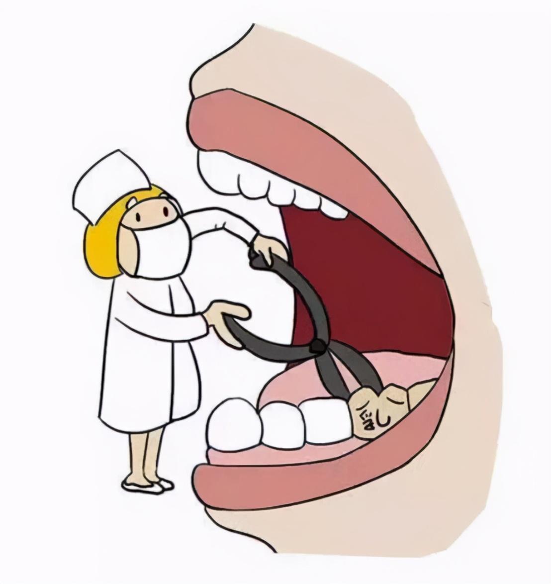 （乳牙大牙会换吗）乳牙都会换，提前掉几颗有关系吗?医生:有关系的  第3张