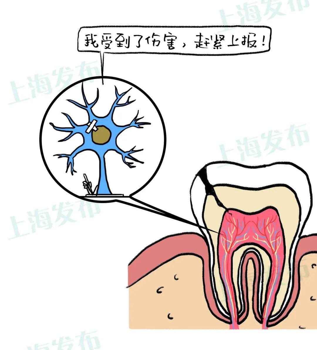 （一颗牙有几根神经）【医聊】怎么结束牙疼?被伤害的牙神经有话说  第6张