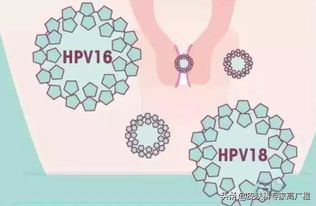 (hpv是什么病)HPV是什么病?哪些亚型需要重视?  第2张