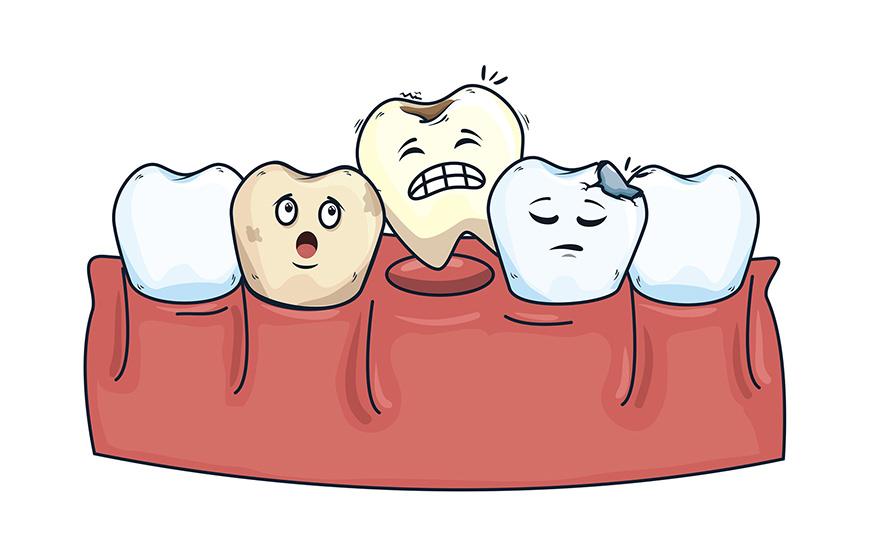 （牙齿松动的治疗办法）牙齿松动还能固定吗?牙齿松动如何治疗呢?  第1张