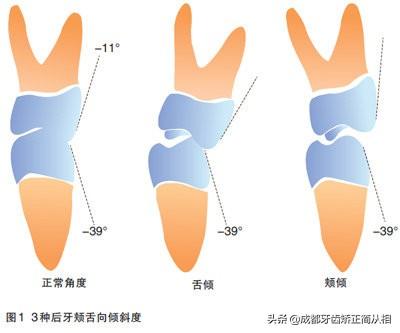 （正常牙齿咬合）怎样判断牙齿咬合功能是否正常?  第3张