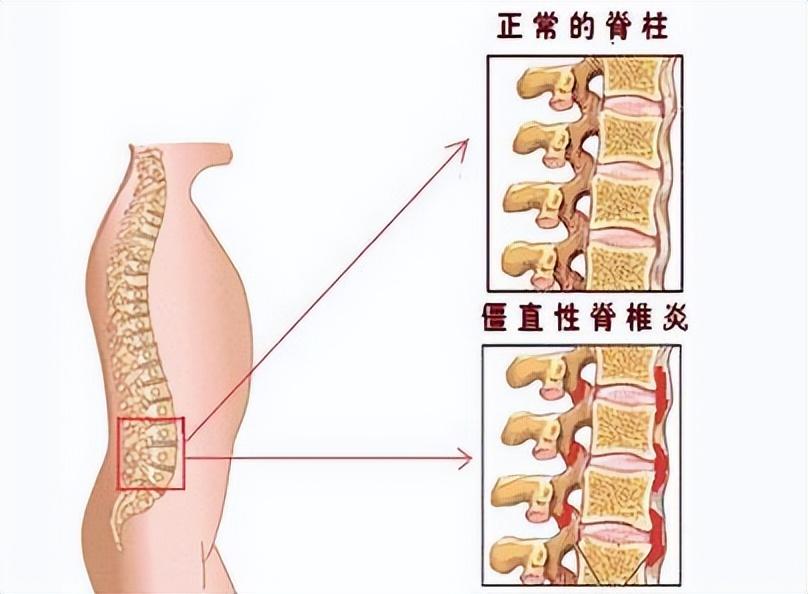 (李宇春身价多少亿)38岁的李宇春患病，为什么身价上亿也治不好?网友:不死的癌症  第4张