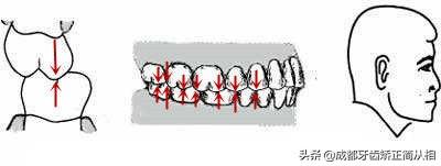（正常牙齿咬合）怎样判断牙齿咬合功能是否正常?  第5张